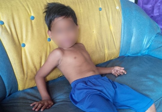 Ferdi Fernando, pengidap penyakit Jantung bocor dan Hernia.